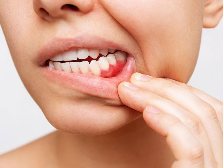 Take Control of Your Oral Health