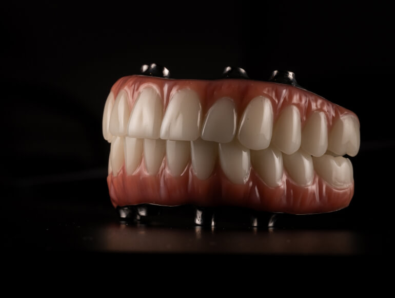 Exploring Tooth Replacement Options