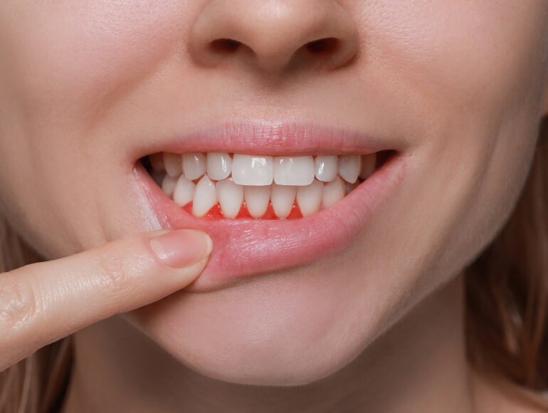 Take Control of Your Oral Health in Manteca CA — Valley View Dental