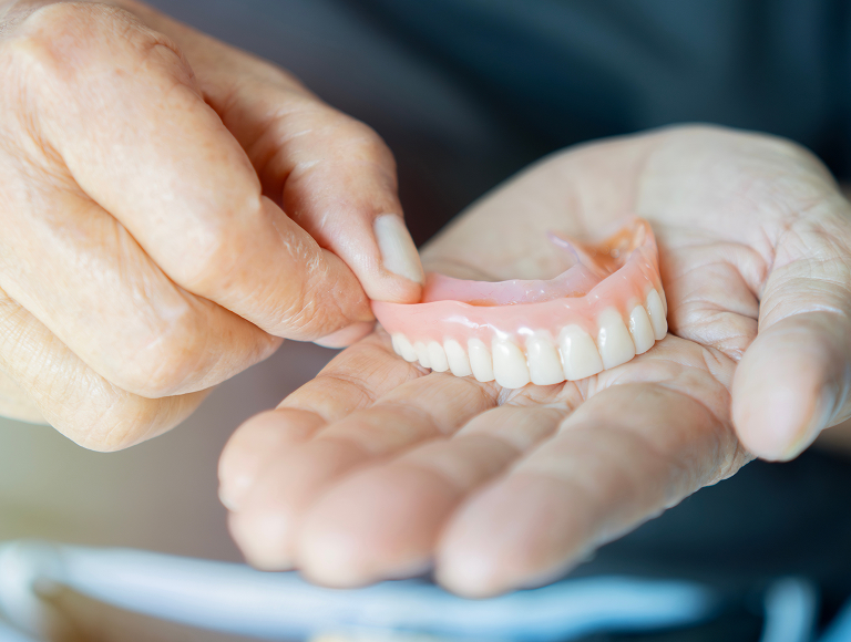 Implant-supported dentures in Tuscaloosa, AL