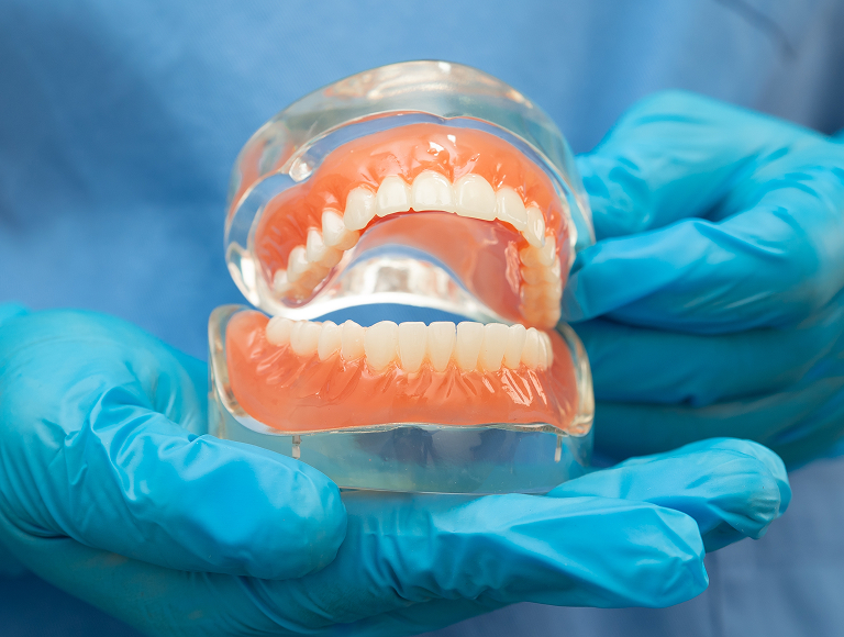 Implant-supported vs traditional dentures